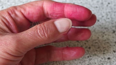 Die verfärbte Hand zeigt Finger, die durch den Kontakt mit Rote Beete rosa gefärbt sind, auf einer hellen Küchenoberfläche.