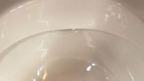 Ein WC mit klarem Wasser, das in der Schüssel steht, zeigt eine saubere Oberfläche ohne Kalkablagerungen.