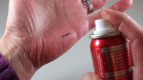 Eine Hand mit blauer Kugelschreibertinte wird mit einer sprayenden Dose in einem neutralen Raum bearbeitet.