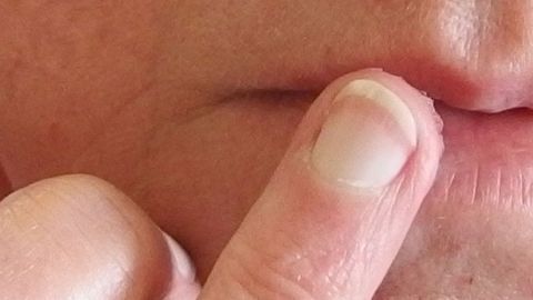 Eine Hand mit einem Finger berührt sanft trockene Lippen, um Vaseline aufzutragen und sie zu befeuchten.