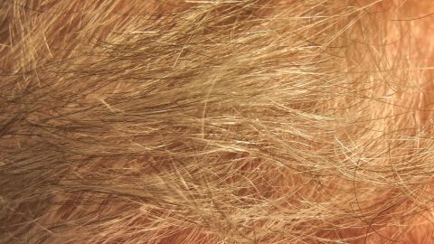 Feines, strähniges Haar liegt durcheinander, was auf ein Problem mit Haarausfall im Alltag hindeutet.
