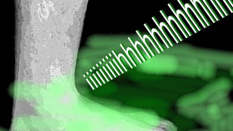 Schweißfüße müssen nicht sein: Mit diesen 7 Tipps aus dem Artikel bleibst Du frisch und sagst unangenehmem Geruch den Kampf an.