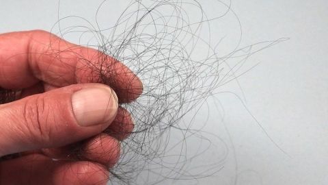 Eine Hand hält einen wirren Haufen aus Haaren, was auf Haarausfall nach Schwangerschaft hinweisen könnte.