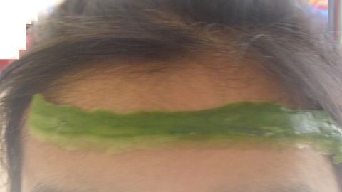 Eine Person trägt eine Gurkenmaske auf der Stirn, um Kopfschmerzen zu lindern, in einer hellen Umgebung.