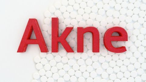 Roten Buchstaben aus "Akne" stehen auf einer weißen Hintergrundleiste mit kleinen weißen Tabletten, die den Fokus auf Hautprobleme lenken.