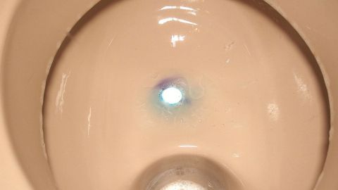 Gegen Gerüche und Ablagerungen helfen Gebissreiniger sehr gut. Ein Toilettenbecken zeigt sich mit einem leichten Wasseransatz und sichtbaren Ablagerungen im Inneren.