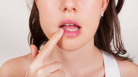 Eine Frau zeigt mit dem Finger auf ihre Lippe, um Herpes zu betonen, vor neutralem Hintergrund.