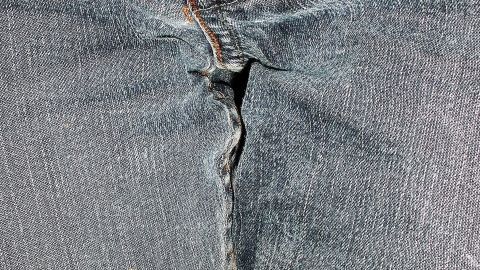 Ein Paar Jeans zeigt einen Riss an der Naht, was mit dem Thema Inkontinenz in Verbindung stehen könnte.