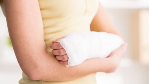 Eine Person mit Gipsarm steht in einem hellen Raum und hält den verletzten Arm vor sich, während sie sich auf das Haare waschen vorbereitet.