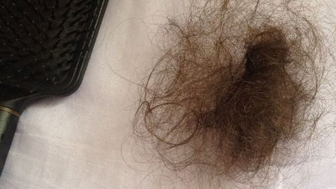 Ein Kamm liegt neben einem Verlust von Haaren auf einem weißen Untergrund, was auf Haarausfall durch Stillen hinweist.