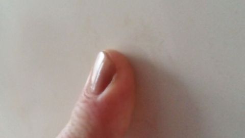 Ein Fingernagel zeigt eine brüchige Stelle, während eine Hand ihn gegen einen weißen Hintergrund hält.
