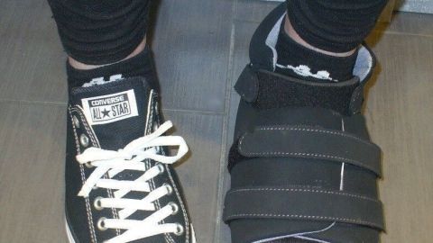 Ein Fuß trägt einen normalen Sneaker, der andere einen speziellen Schuh für Hallux valgus, der stabilisiert und entlastet.