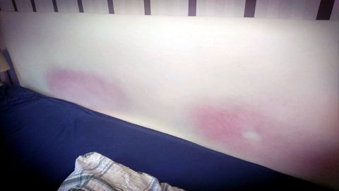 Eine helle Wand zeigt Verfärbungen auf Kunstleder, die aufgrund von Kontakt entstanden sind, umgeben von einem Bett.