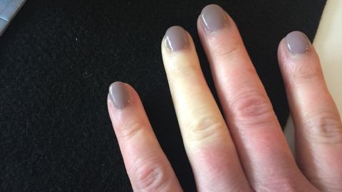 Helle, gefühllose Finger zeigen eine blass-weiße Färbung auf dunklem Untergrund, was auf das Raynaud-Syndrom hindeutet.