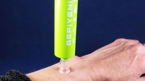 Ein handlicher, grüner Venenzuggerät wird auf eine Hautstelle gedrückt, um schnell Erste Hilfe bei Insektenstichen zu leisten.