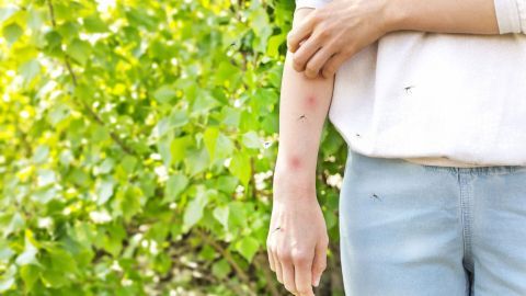 Ein Arm mit roten Mückenstichen wird von mehreren Mücken umschwirrt, vor einem Hintergrund aus grünen Blättern.