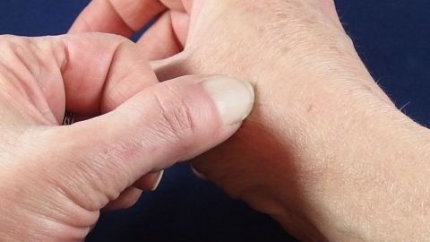 Eine Hand drückt sanft auf einen Mückenstich am Handgelenk, um den Juckreiz zu lindern. Die Umgebung ist dunkelblau.