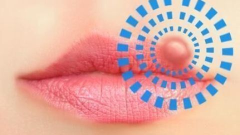 Sanfte Lippen zeigen eine grafische Darstellung eines Herpesbläschen, während Ballistol zur Linderung wirkt.
