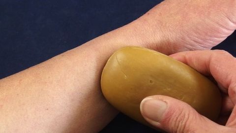 Mückenstich: Seife oder Speichel lindert den Juckreiz. Eine Hand reibt mit einem Stück Seife über einen Mückenstich auf einem Unterarm, um den Juckreiz zu lindern.