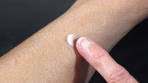 Mit Zahnpasta den Juckreiz nach Insektenstichen lindern. Ein Finger verteilt eine kleine Menge Zahnpasta auf einem Hautausschlag am Arm, um Juckreiz bei Insektenstichen zu lindern.