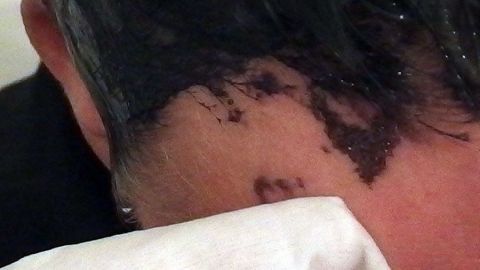 Ränder von Haarfarbe mit Babyfeuchttüchern entfernen. Ein Kopf mit gefärbtem Haar wird mit einem Babyfeuchttuch gereinigt, um Überreste der Haarfarbe zu entfernen.