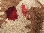 Spucke gegen Blutflecken