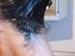 Haarfarbe von der Haut entfernen