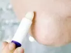 Lippenpflegestift gegen rauhe Ellenbogen
