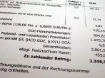 Kosten sparen beim Zahnersatz