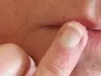 Vaseline gegen trockene Lippen