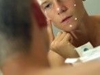 Vitamin B5 und Cordes BPO gegen Pickel & Akne