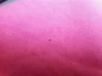 Kleine Löcher in der Kleidung verhindern