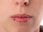 Lippen im Winter richtig pflegen
