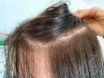Von schwarz gefärbten Haaren zurück zur hellen Naturhaarfarbe