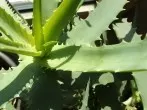 Pickel weg mit Aloe Vera Gel
