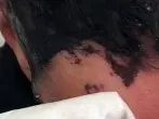 Haare färben - Ränder entfernen mit Babyfeuchttüchern