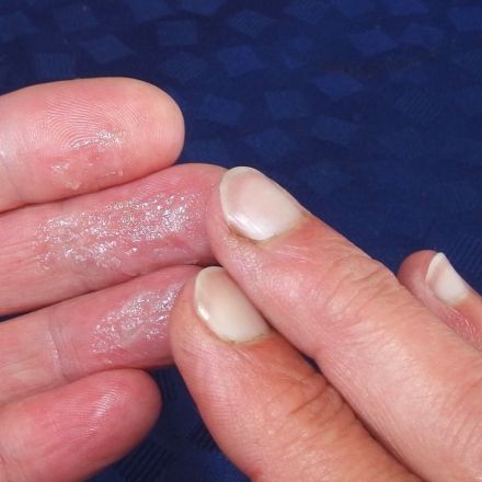 Melkfett statt teurer Cremes