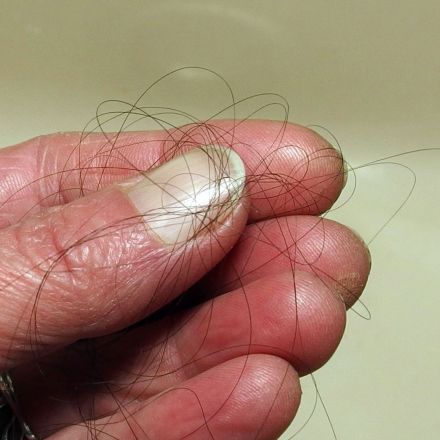 Abfluss verstopft? Ursache Haare?