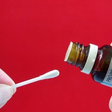 Propolis-Tropfen gegen Lippenherpes
