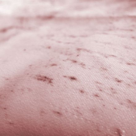 Stockflecken entfernen mit Essig