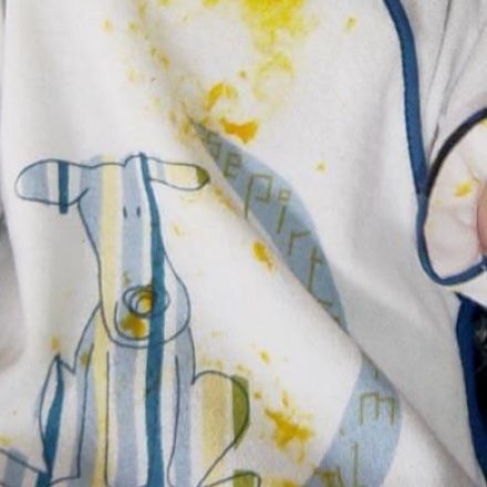 Babybreiflecken verschwinden lassen