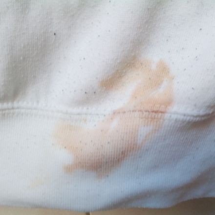 Alle Flecken entfernen II