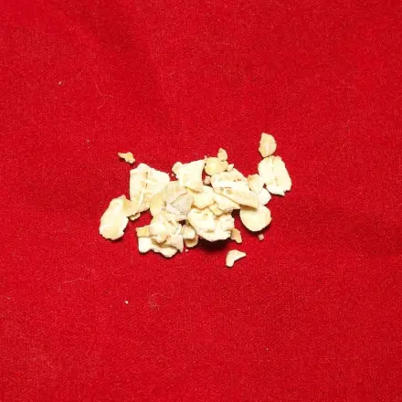 Bei kleinen Kindern den Juckreiz von Mückenstichen lindern