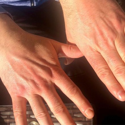 Tipp gegen raue Hände