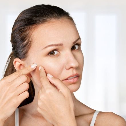 Gut gegen Pickel: Aspirin