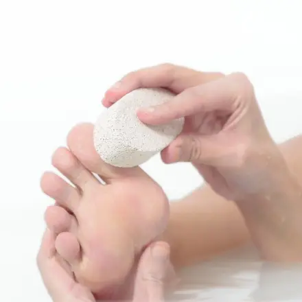 Fußsohlenwarzen bzw. Dornwarzen entfernen