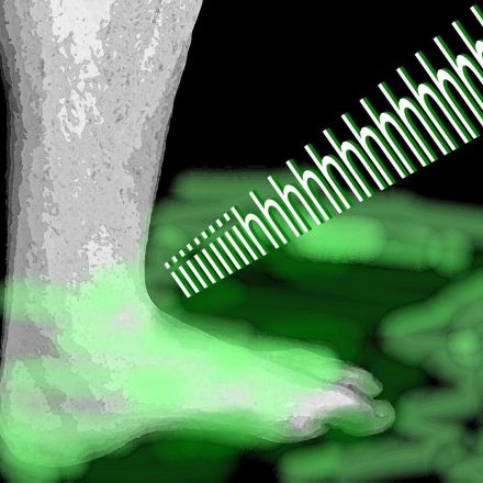 7 Tipps gegen Schweißfüße