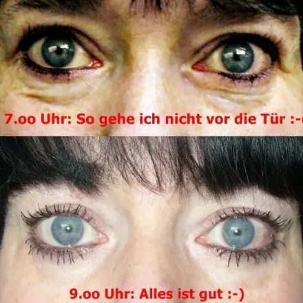 Koffein Augen-Roll-On gegen Tränensäcke, Augenringe & Schwellungen