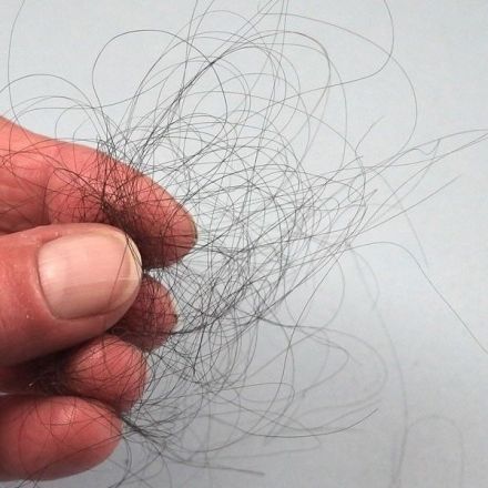 Haarausfall nach Schwangerschaft