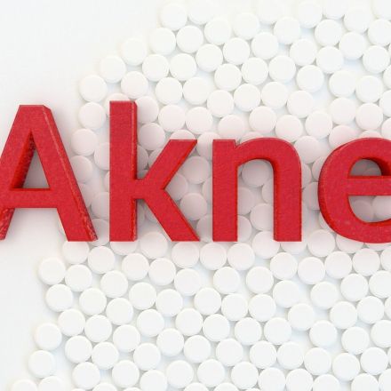 Schwere Akne loswerden - langfristig